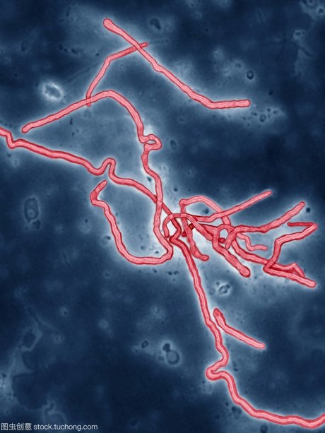 艾博拉病毒_360图片