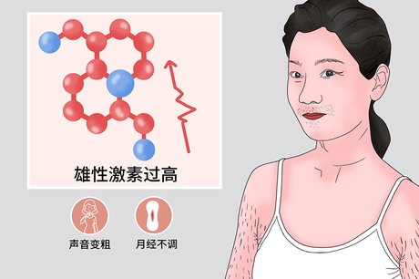 多毛症 360图片