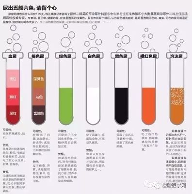 小便茶色是怎么回事