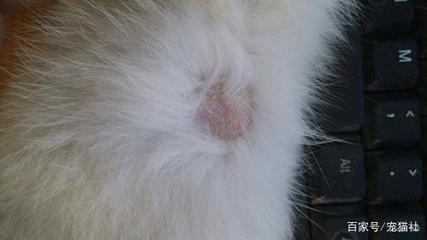 人长猫癣怎么治疗