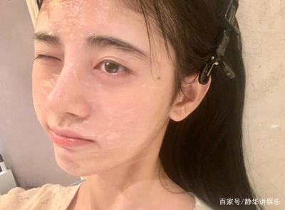 脸上雀斑痘痘怎么护肤