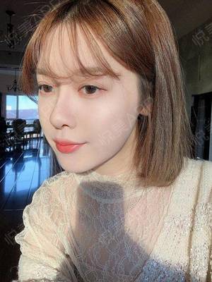 双眼皮越久越自然吗