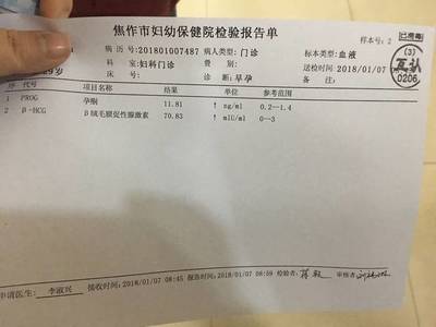 刚好30天能测出怀孕吗