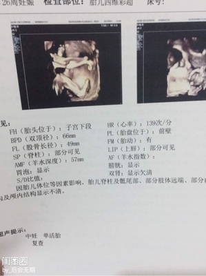 怀孕26周胎儿有多大