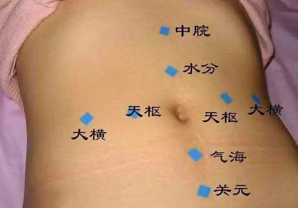 减肥的穴位有哪些