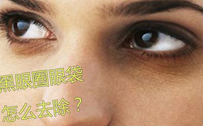 眼霜去黑眼圈有用吗