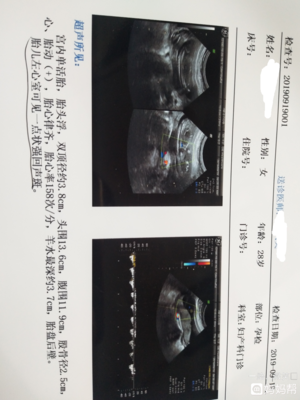 十七周的胎儿彩超图