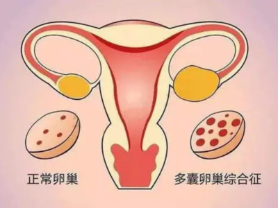 一个卵巢可以怀孕吗