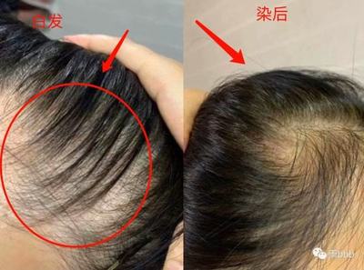 刚怀孕可以染头发吗