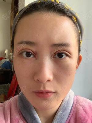 化妆之后脸很干怎么办