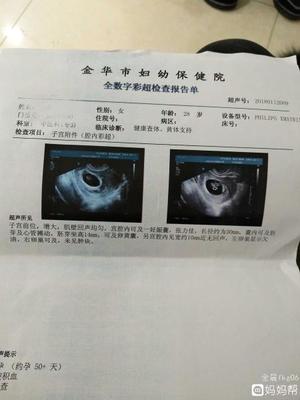 染色体平衡易位孕9个月