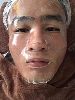 脸上长痘痘用肤大夫
