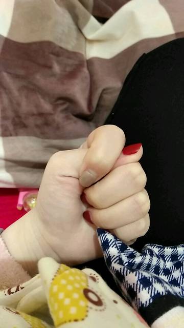 一岁宝宝拇指内扣