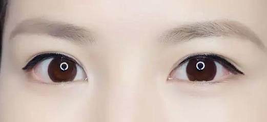 桃花眼必须是双眼皮吗