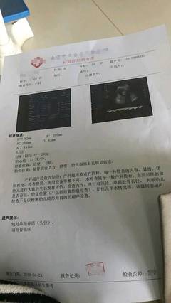 甲状腺偏小是怎么回事