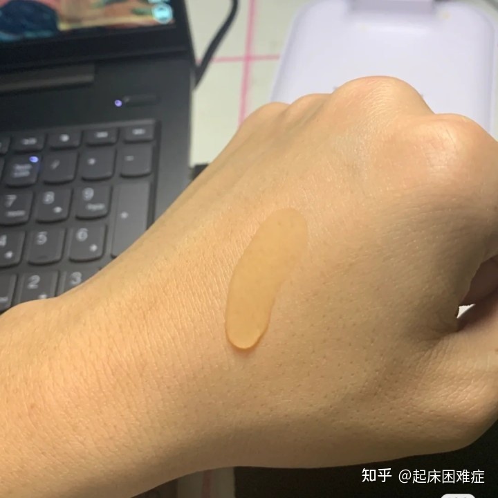 怎样才能淡化痘印