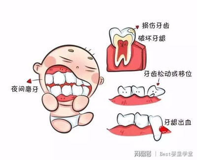一岁宝宝牙龈出血