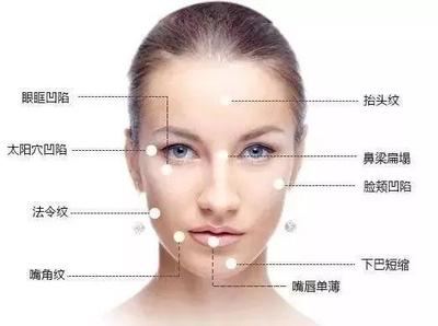 玻尿酸去抬头纹能保持