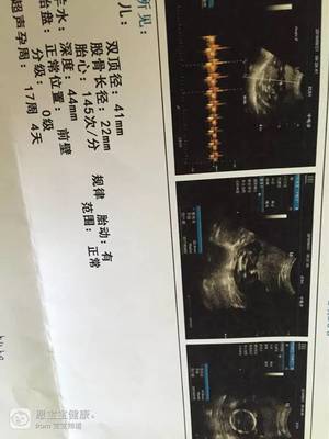 怀孕十七周有胎动吗