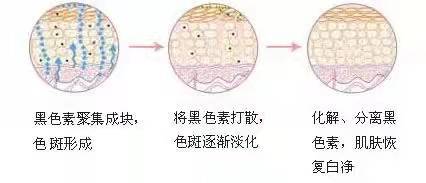 挤痘痘之后的伤口愈合