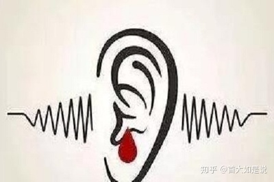得了耳鸣怎么治疗