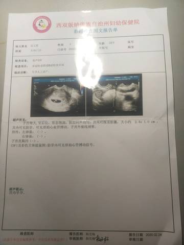 怀孕40天能看出男女吗