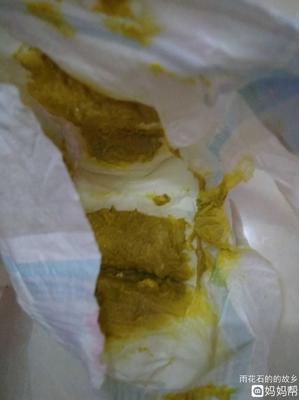 宝宝大便青色