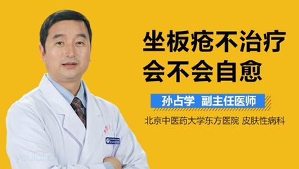 坐板疮怎么治疗