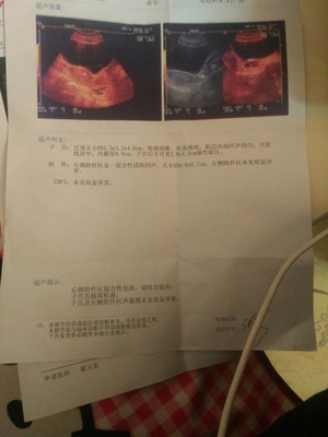 怀孕孕囊图片
