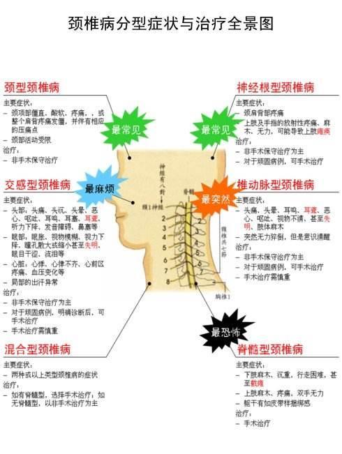 神经根颈椎病怎么治疗最好