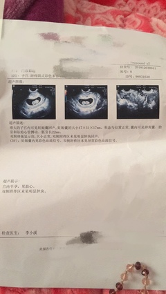 怀孕40天能看出男女吗