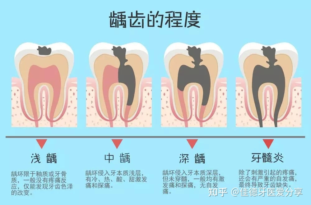 补牙很痛吗