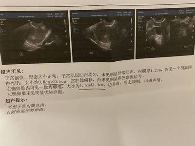 内膜息肉会影响怀孕吗