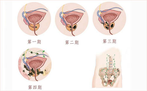 肿怎么治疗