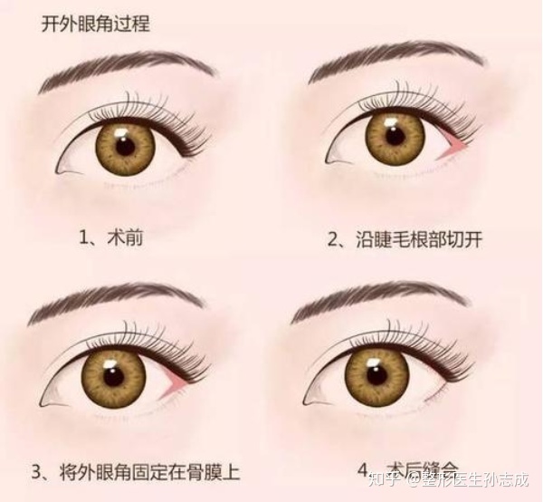 开眼角下至