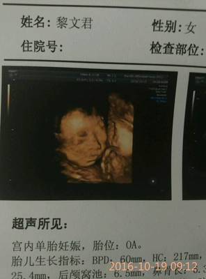 怀孕19周感觉不到胎动