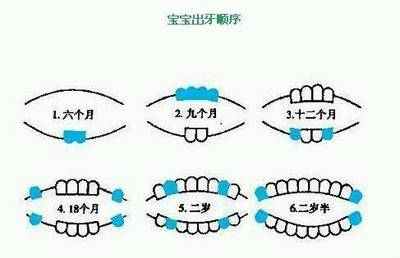 宝宝出牙顺序图