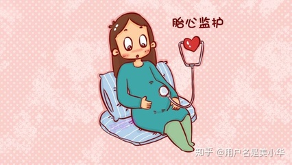 胎儿胎心
