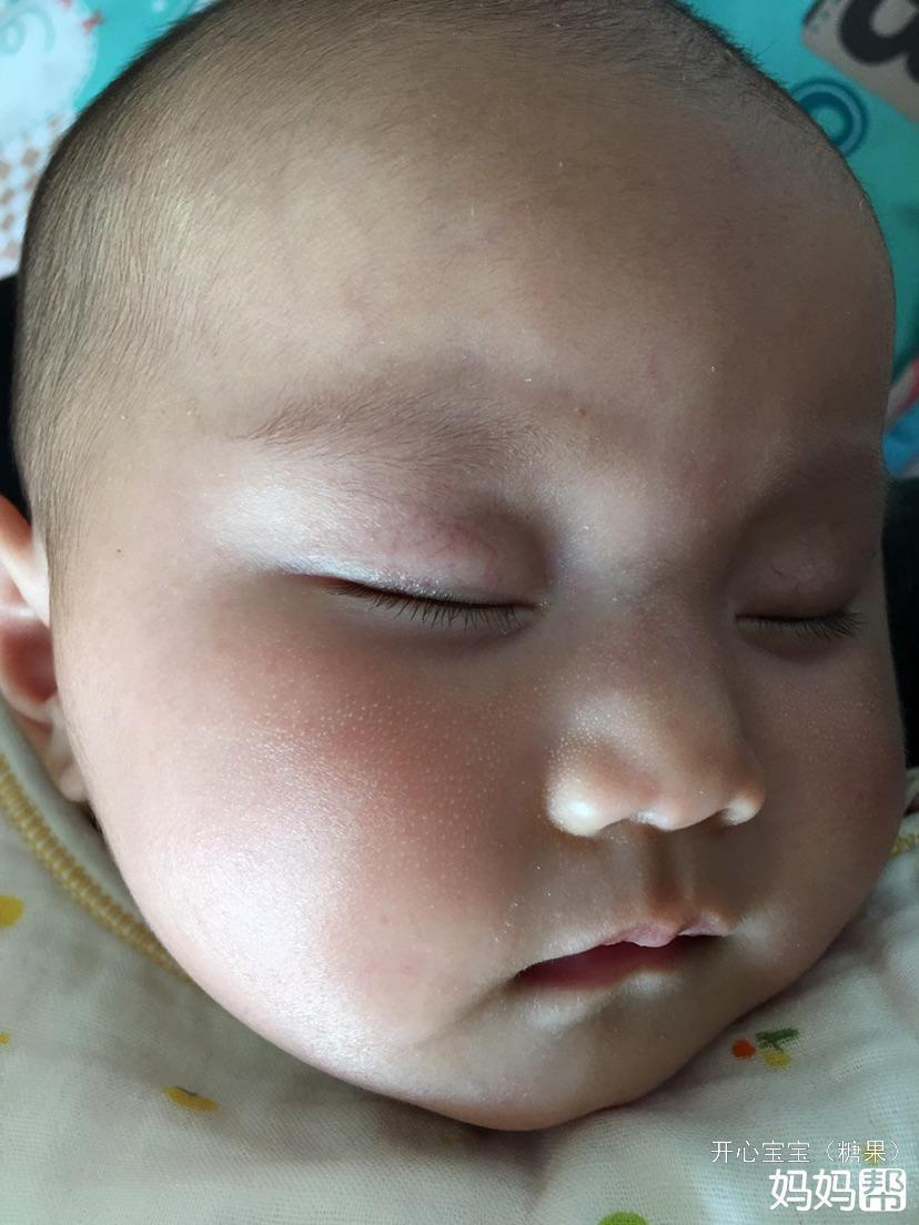 新生儿鼻子有白点怎么回事