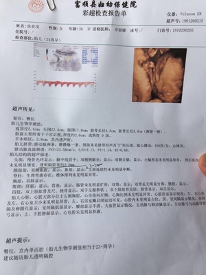 胎儿智障能检查出来吗
