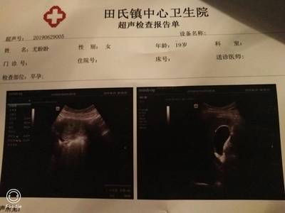 月经前三天会怀孕吗