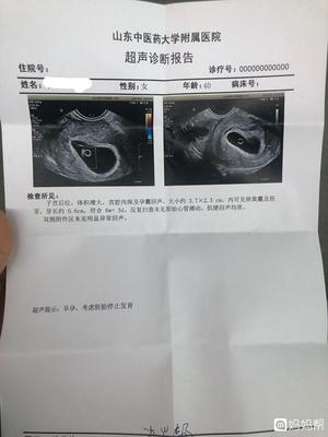 怀孕四十五天有什么反应