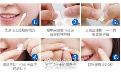 痘痘脓水挤不完