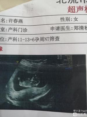 怀孕拉屎出血