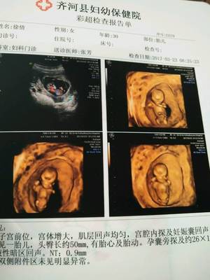 孕11周是几个月