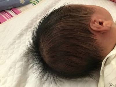 胎宝宝什么时候长头发