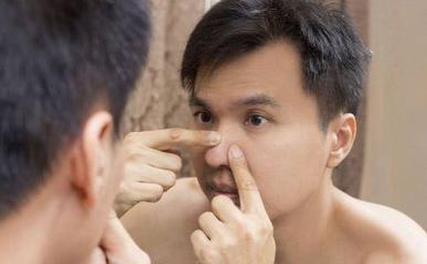 男人脸上长痘痘怎么调理