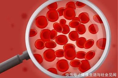 血小板低是怎么回事有什么危害吗
