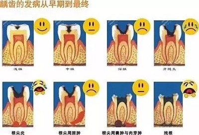 牙齿一吃东西就疼是怎么回事