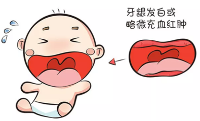 宝宝牙龈红肿充血图片
